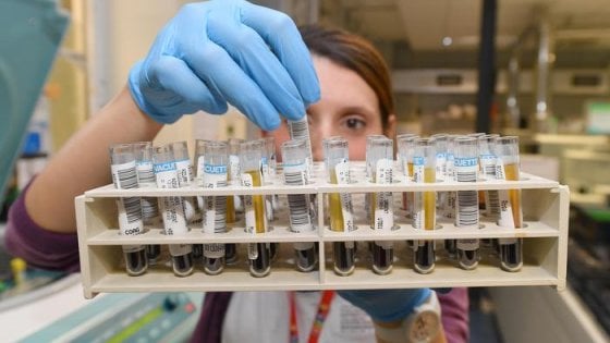La Commissione europea approva gilteritinib di Astellas in monoterapia per pazienti con leucemia acuta mieloide recidivante o refrattaria con mutazione FLT3