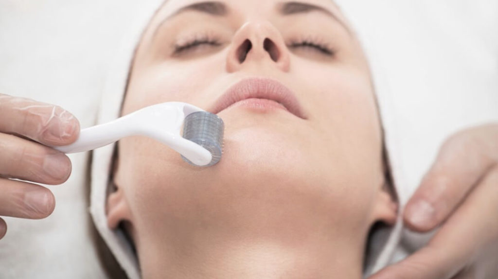 Needling: cos’è e a cosa serve