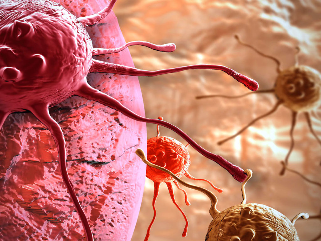 All’IRCCS di Negrar Radioterapia e risonanza magnetica sulla stessa macchina: cure efficaci e brevi contro il tumore senza coinvolgere i tessuti sani